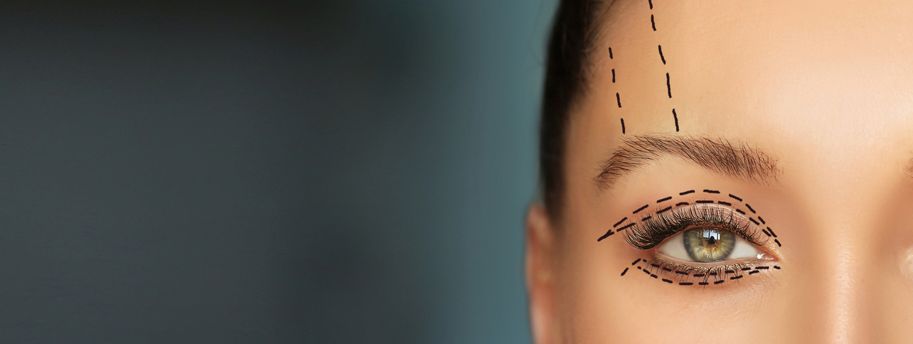 Brow Lift