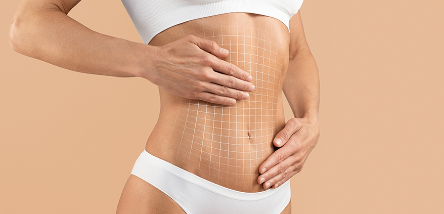 Tummy Tuck