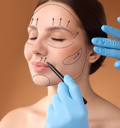 Facial Surgery